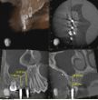 3D-DVT-Planung.jpg