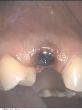 SI-Impl.-5.jpg