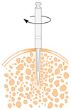 implantation1.jpg